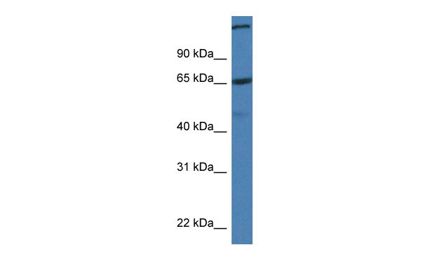 WB Suggested Anti-St6galnac1 Antibody Titration: 1.0 ug/ml Positive Control: Mouse Pancreas