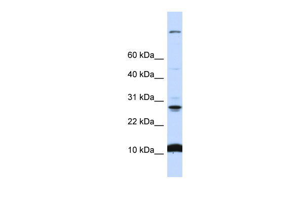 WB Suggested Anti-C19orf56 Antibody Titration: 0.2-1 ug/ml ELISA Titer: 1:312500 Positive Control: 721_B cell lysateWDR83OS is supported by BioGPS gene expression data to be expressed in 721_B