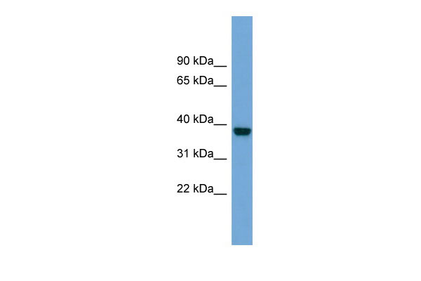 WB Suggested Anti-ATP1B4 Antibody Titration: 0.2-1 ug/ml Positive Control: COLO205 cell lysate