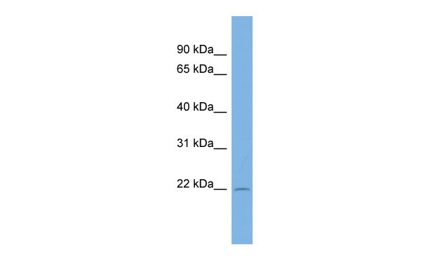 WB Suggested Anti-C13orf28 Antibody Titration: 0.2-1 ug/ml ELISA Titer: 1:62500 Positive Control: COLO205 cell lysate