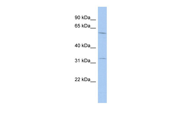 WB Suggested Anti-FLJ20628 Antibody Titration: 0.2-1 ug/ml ELISA Titer: 1:12500 Positive Control: SH-SYSY cell lysateTRMT61B is supported by BioGPS gene expression data to be expressed in SHSY5Y