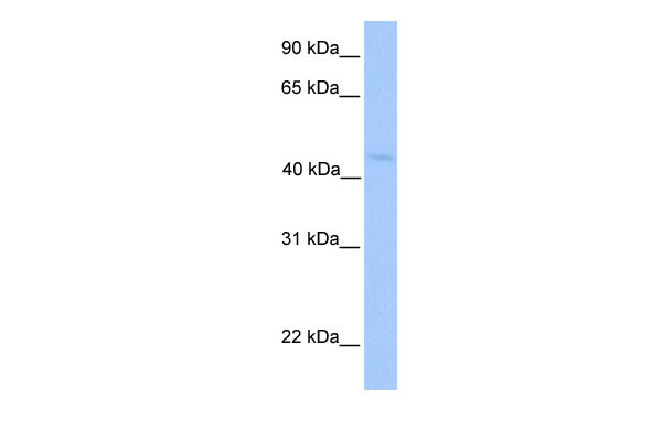WB Suggested Anti-LIPT1 Antibody Titration: 0.2-1 ug/ml Positive Control: Hela cell lysate