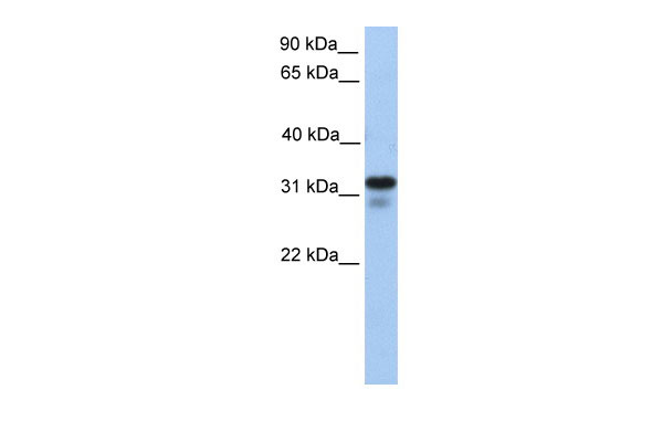 WB Suggested Anti-HS3ST6 Antibody Titration: 0.2-1 ug/ml Positive Control: 721_B cell lysate