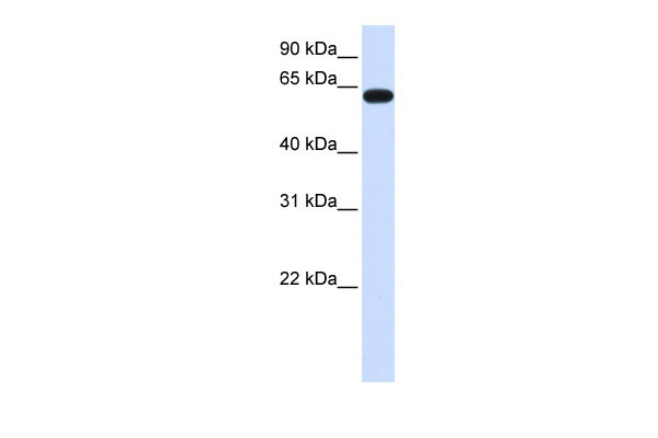 WB Suggested Anti-HS6ST3 Antibody Titration: 0.2-1 ug/ml ELISA Titer: 1:312500 Positive Control: Human brain