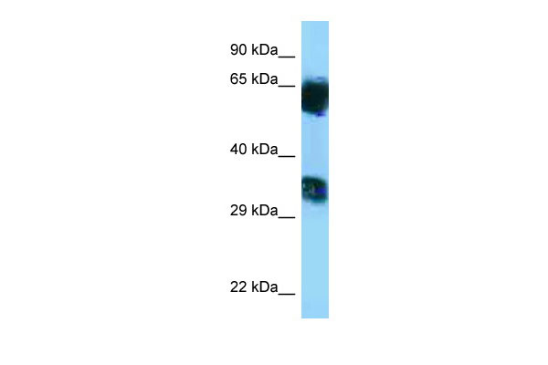 WB Suggested Anti-Mgat5b Antibody Titration: 1.0 ug/ml Positive Control: Rat Muscle