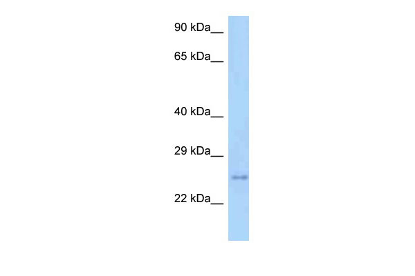WB Suggested Anti-Tm2d3 Antibody Titration: 1.0 ug/ml Positive Control: Mouse Heart