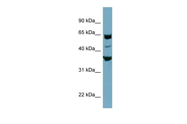 WB Suggested Anti-SEC22C Antibody Titration: 0.2-1 ug/ml ELISA Titer: 1:1562500 Positive Control: PANC1 cell lysate