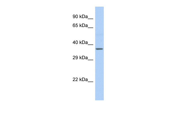 Host: Rabbit Target Name: cytb Sample Tissue: Fetal Liver lysates Antibody Dilution: 1.0ug/ml