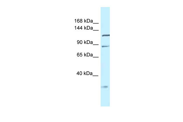 WB Suggested Anti-Tmem132d Antibody Titration: 1.0 ug/ml Positive Control: Mouse Liver