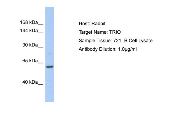 Host: Rabbit Target Name: TRIO Sample Tissue: 721_B Whole Cell lysates Antibody Dilution: 1.0ug/mlTRIO is strongly supported by BioGPS gene expression data to be expressed in Human 721_B cells