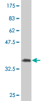 Antibody Reactive Against Recombinant Protein.Western Blot detection against Immunogen (33.99 KDa) . 