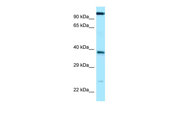 WB Suggested Anti-LOC647589 Antibody Titration: 1.0 ug/ml Positive Control: ACHN Whole Cell
