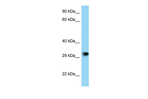 WB Suggested Anti-Phf23 Antibody Titration: 1.0 ug/ml Positive Control: Mouse Brain