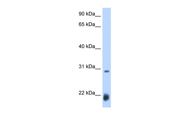 WB Suggested Anti-ac Antibody Titration: 0.2-1 ug/ml Positive Control: Drosophila