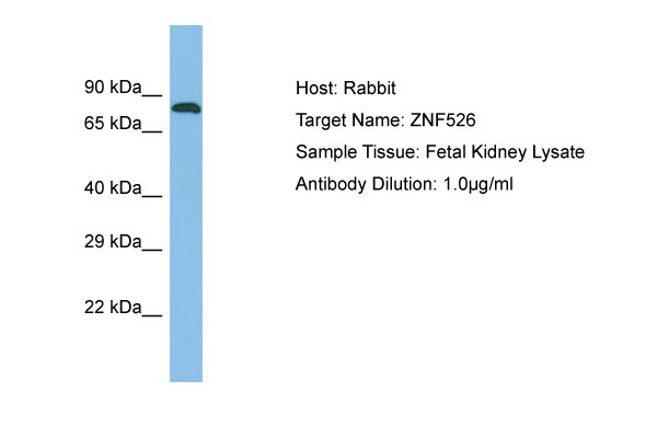 Host: Rabbit Target Name: ZNF526 Sample Tissue: Fetal Kidney lysates Antibody Dilution: 1.0ug/ml