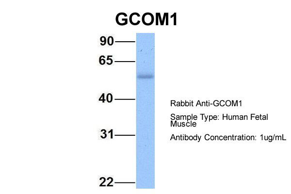Host:Rabbit Target Name:GCOM1 Sample Tissue:Human Fetal Muscle Antibody Dilution: 1.0ug/ml