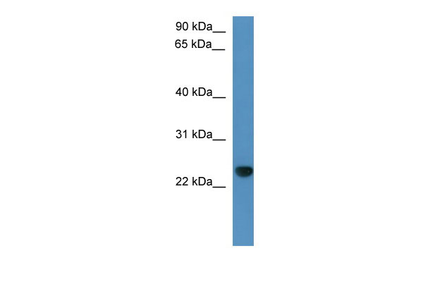 WB Suggested Anti-Capsl Antibody Titration: 0.2-1 ug/ml ELISA Titer: 1:312500 Positive Control: Rat Liver