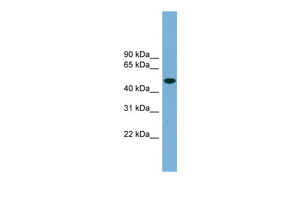 WB Suggested Anti-UBQLNL Antibody Titration: 0.2-1 ug/ml Positive Control: 293T cell lysate