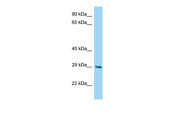 WB Suggested Anti-Fam122b Antibody Titration: 1.0 ug/ml Positive Control: Mouse Liver