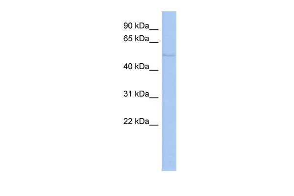 WB Suggested Anti-TIGD4 Antibody Titration: 0.2-1 ug/ml ELISA Titer: 1:62500 Positive Control: HepG2 cell lysate