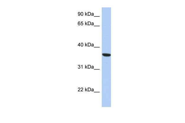 WB Suggested Anti-PSTK Antibody Titration: 0.2-1 ug/ml ELISA Titer: 1:12500 Positive Control: THP-1 cell lysate