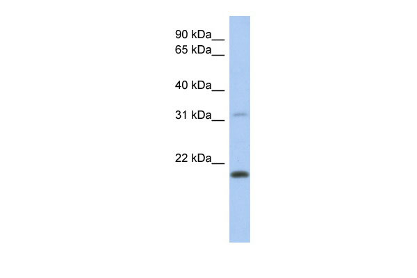 WB Suggested Anti-CLECL1 Antibody Titration: 0.2-1 ug/ml ELISA Titer: 1:12500 Positive Control: Human Placenta