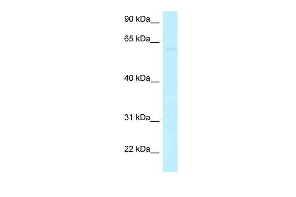 WB Suggested Anti-CCDC105 Antibody Titration: 1.0 ug/ml Positive Control: Hela Whole Cell