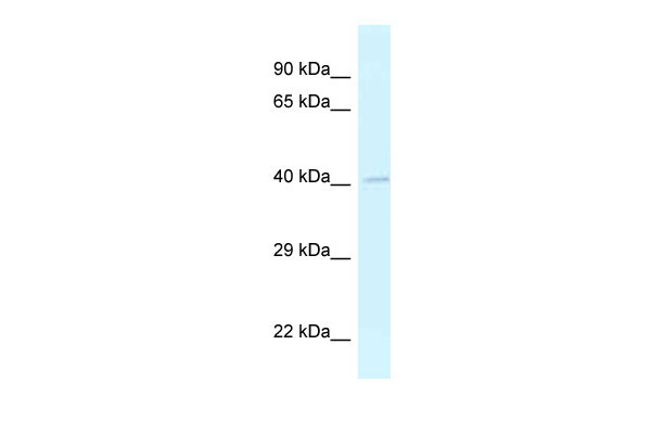 WB Suggested Anti-Grasp Antibody Titration: 1.0 ug/ml Positive Control: Mouse Small Intestine