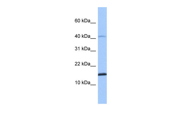 WB Suggested Anti-SPAG11B Antibody Titration: 0.2-1 ug/ml Positive Control: Human Muscle