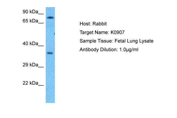 Host: Rabbit Target Name: K0907 Sample Tissue: Fetal Lung lysates Antibody Dilution: 1.0ug/ml