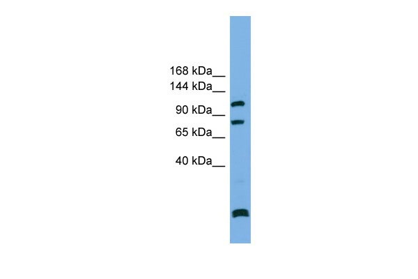 WB Suggested Anti-PPP6R1 Antibody Titration: 0.2-1 ug/ml Positive Control: RPMI 8226 cell lysatePPP6R1 is supported by BioGPS gene expression data to be expressed in RPMI 8226