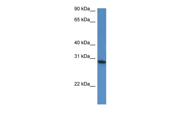 WB Suggested Anti-Fam168a Antibody Titration: 1.0 ug/ml Positive Control: Mouse Heart