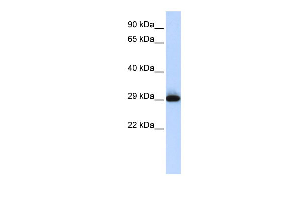 WB Suggested Anti-SUSD3 Antibody Titration: 0.2-1 ug/ml ELISA Titer: 1:12500 Positive Control: Human Placenta