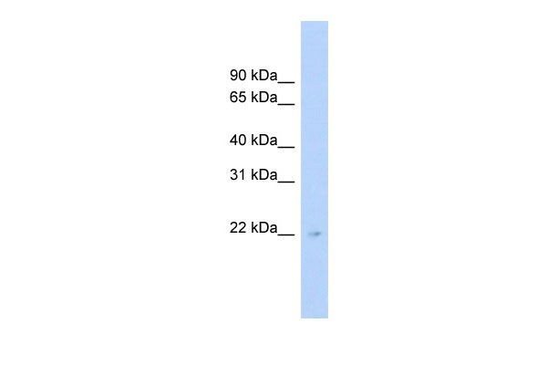 WB Suggested Anti-C16orf73 Antibody Titration: 0.2-1 ug/ml Positive Control: Human Liver