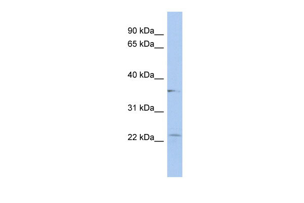 WB Suggested Anti-LYSMD2 Antibody Titration: 0.2-1 ug/ml ELISA Titer: 1:312500 Positive Control: HepG2 cell lysate