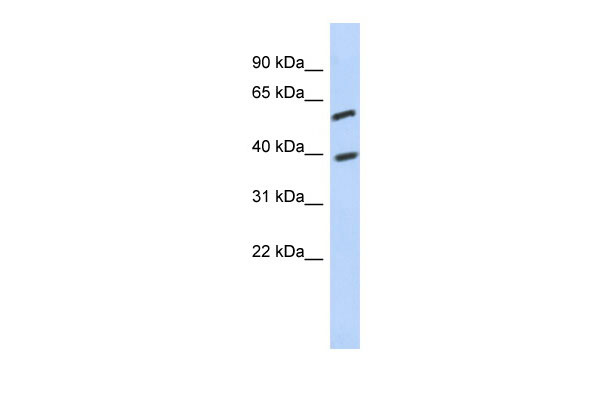 WB Suggested Anti-C6orf146 Antibody Titration: 0.2-1 ug/ml ELISA Titer: 1:312500 Positive Control: Jurkat cell lysate