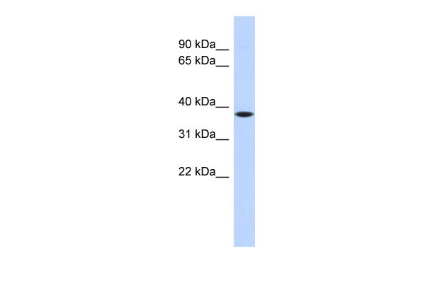 WB Suggested Anti-C22orf30 Antibody Titration: 0.2-1 ug/ml ELISA Titer: 1:1562500 Positive Control: Hela cell lysate