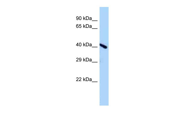 WB Suggested Anti-A730011L01Rik Antibody Titration: 1.0 ug/ml Positive Control: Mouse Brain