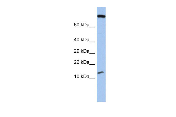 WB Suggested Anti-FLJ37543 Antibody Titration: 0.2-1 ug/ml ELISA Titer: 1:312500 Positive Control: Human Stomach