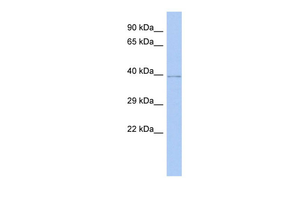 WB Suggested Anti-WDR53 Antibody Titration: 0.2-1 ug/ml ELISA Titer: 1:1562500 Positive Control: Human brain