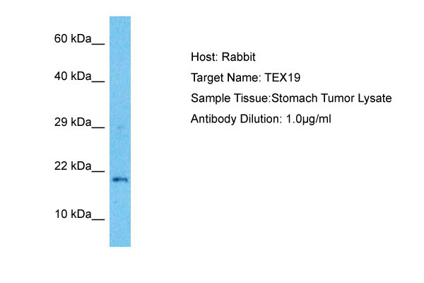 Host: Rabbit Target Name: TEX19 Sample Tissue: Stomach Tumor lysates Antibody Dilution: 1.0ug/ml