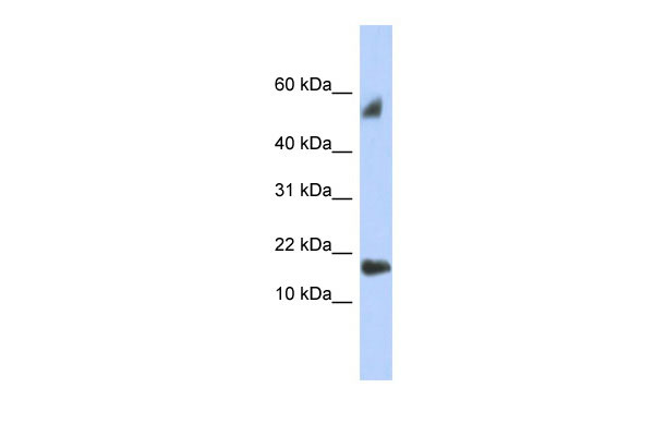 WB Suggested Anti-FLJ35767 Antibody Titration: 0.2-1 ug/ml ELISA Titer: 1:1562500 Positive Control: Human Placenta