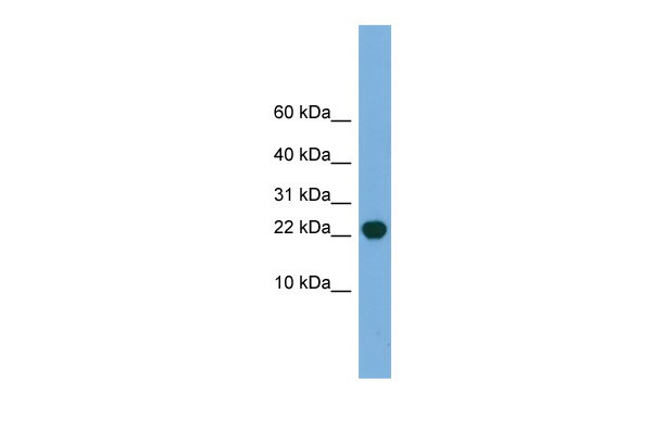 WB Suggested Anti-POP5 Antibody Titration: 0.2-1 ug/ml Positive Control: Human Lung