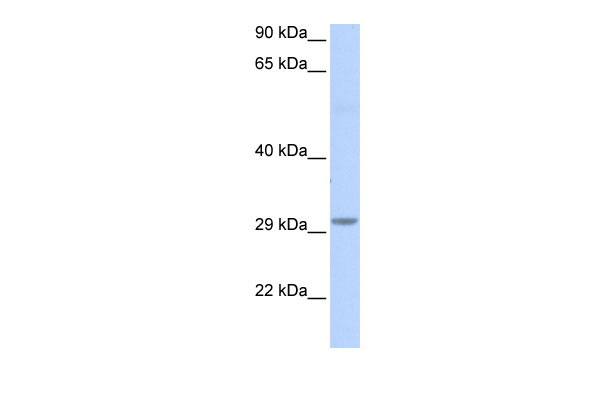 WB Suggested Anti-FAM108B1 Antibody Titration: 0.2-1 ug/ml ELISA Titer: 1:312500 Positive Control: Human brain