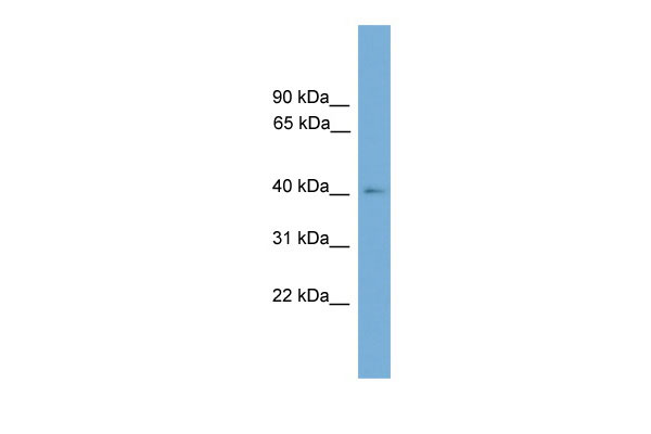 WB Suggested Anti-THEG Antibody Titration: 0.2-1 ug/ml ELISA Titer: 1:0 Positive Control: Hela cell lysate