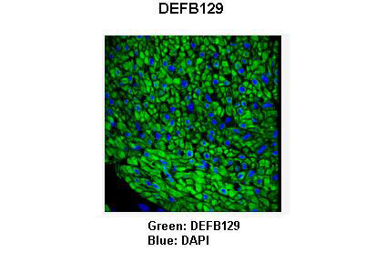Sample Type : Pig bronchus smooth muscle cells Primary Antibody Dilution : 1:100 Secondary Antibody : Goat anti-rabbit-FITC Secondary Antibody Dilution : 1:100 Color/Signal Descriptions : Green: DEFB129Blue: DAPI Gene Name : DEFB129 Submitted by : Anonymous