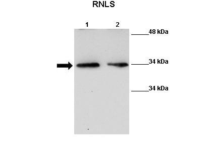 WB Suggested Anti-Rnls Antibody Positive Control: Lane 1: 40ug Mouse liver tissue lysate Lane 2: 40ug Mouse liver tissue lysate Primary Antibody Dilution : 1:500 Secondary Antibody : Anti-rabbit-HRP Secondry Antibody Dilution : 1:2500 Submitted by: Nitish R Mahapatra, IIT Madras