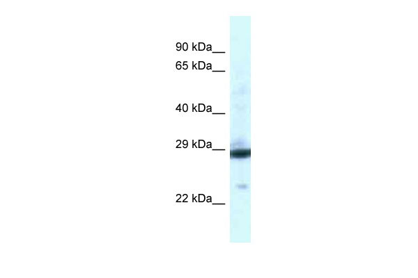 WB Suggested Anti-PGAM1 Antibody Titration: 1.0 ug/ml Positive Control: Fetal Liver