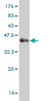 Antibody Reactive Against Recombinant Protein.Western Blot detection against Immunogen (44.33 KDa) .