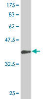 Antibody Reactive Against Recombinant Protein.Western Blot detection against Immunogen (44.33 KDa) . 
